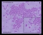 bordetella pertussis micrograph